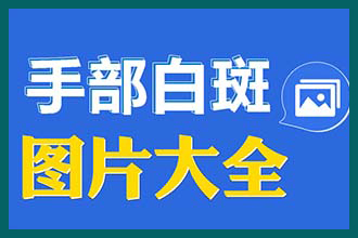 下面有白点是怎么回事呢.是不是白癜风这么难治疗